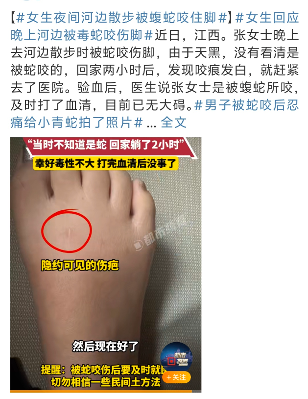 解梦被蛇咬 周公解梦梦见被蛇咬