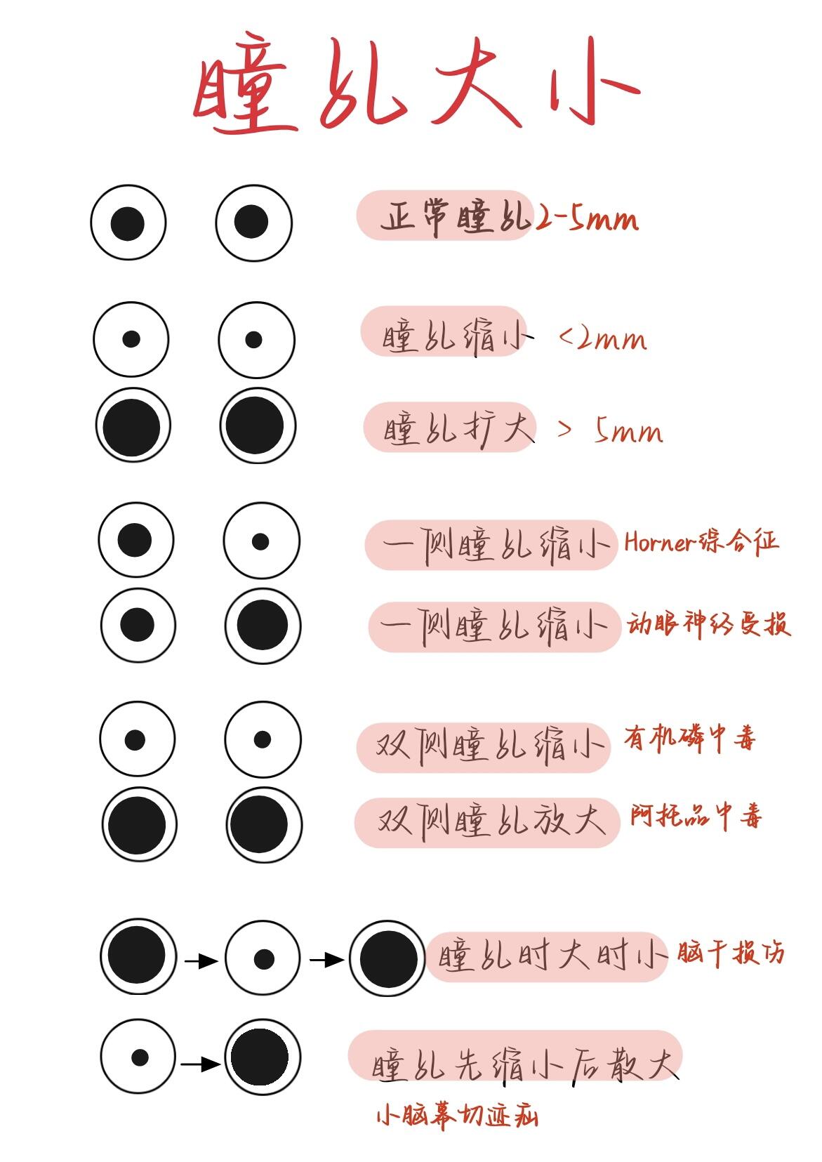 白眼球大黑眼球小 白眼球大黑眼球小的区别 白眼球大黑眼球小 白眼球大黑眼球小的区别