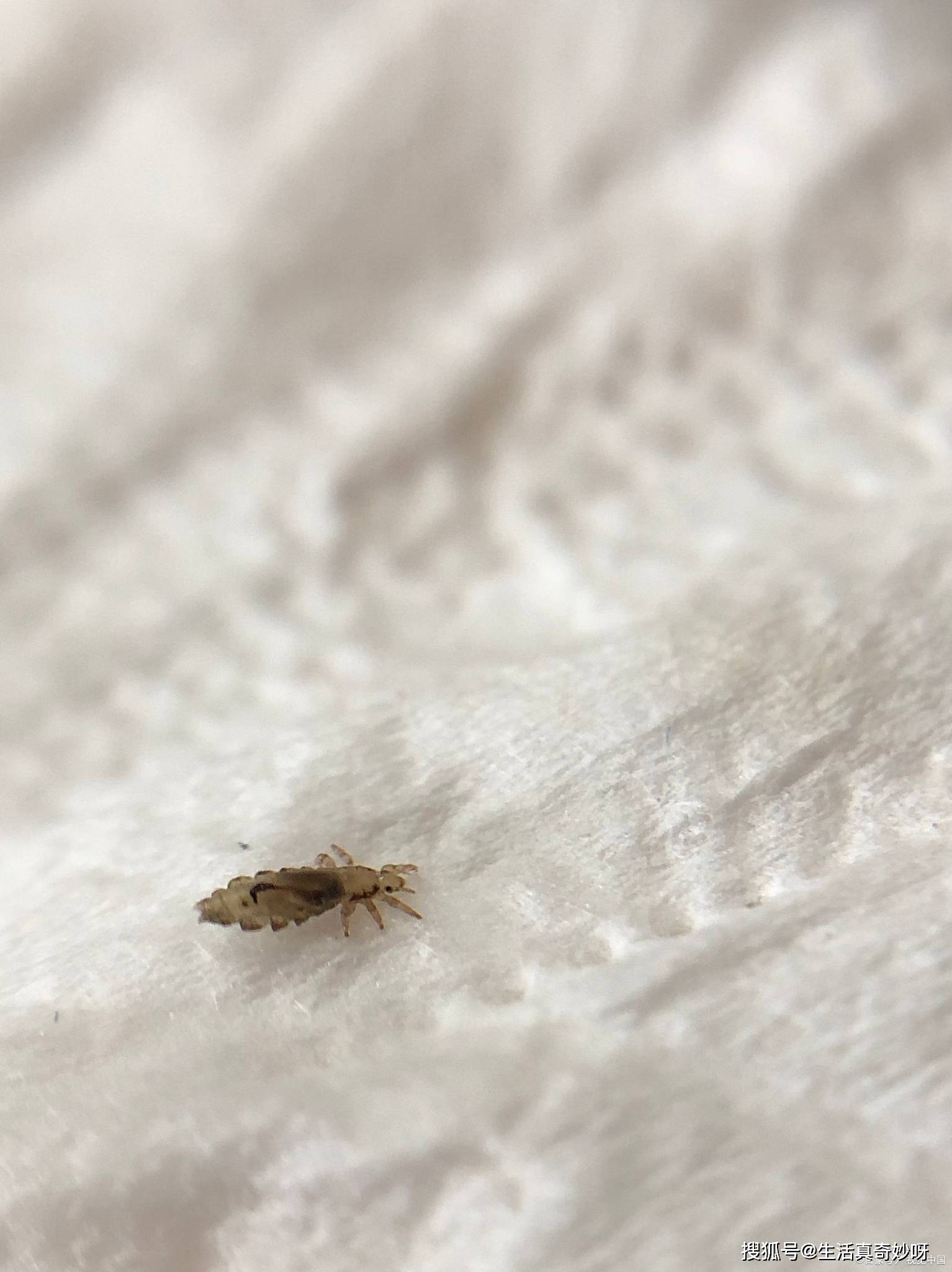 周公解梦生虱子 做梦头上生虱子是什么征兆