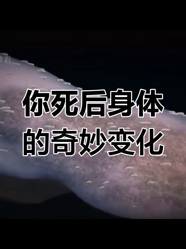 周公解梦身上长蛆虫 梦见身上长蛆是什么预兆