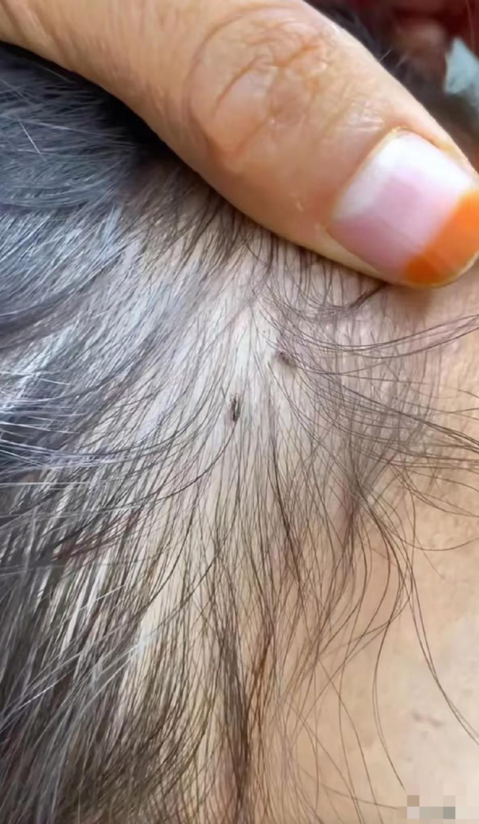 周公解梦虱子 周公解梦狮子大象