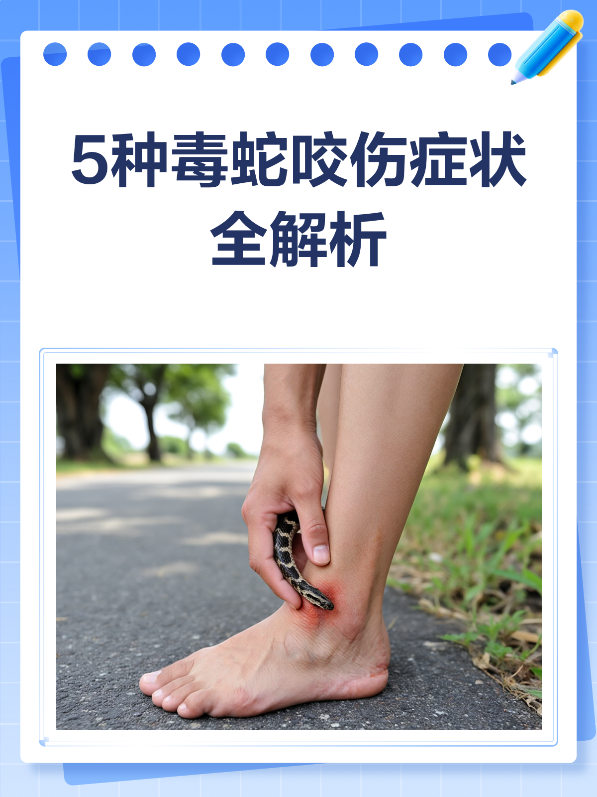 周公解梦大全被蛇咬 梦里被蛇咬了代表什么